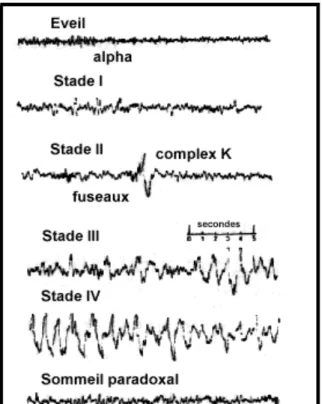 Fig. 9 : Types d’EEG à différents stades de sommeil  (Sherwood, Physiologie humaine, Ed
