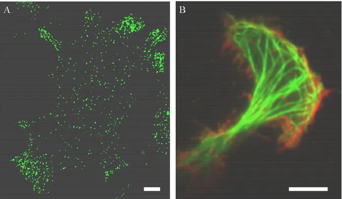 Figure 2 : Exemples d'images obtenues par microscopie de fluorescence. (A) Image obtenue en microscopie  à épifluorescence puis traitée par déconvolution, d'une cellule neuroendocrine de la lignée BON dont les  granules de sécrétion sont marqués par le neu