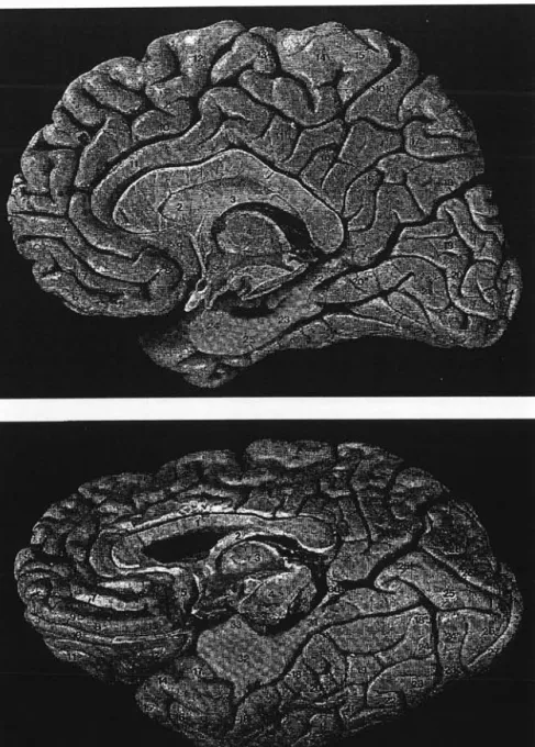 figure 2 : Gyrus parahippocampique