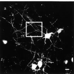 Figure  1.6:  In vivo  imaging  of  dendrites  and  dendritic  spines.  Scale  bar:  1011m [121.