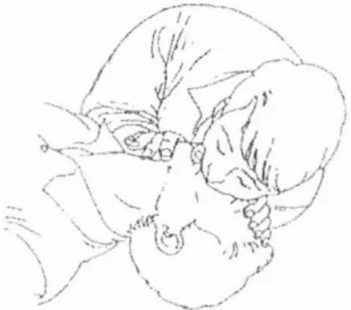 Figure 6 : bouche - à nez (9).