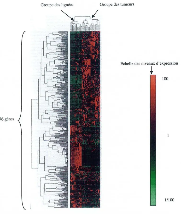 Figure 8 : Représentation schématique des niveaux d'expression de 576 gènes dans JJ lignées cellulaires cancéreuses mammaires et J 5 échantillons de cancer du sein (schéma adapté d'après Bertucci et al [69]).