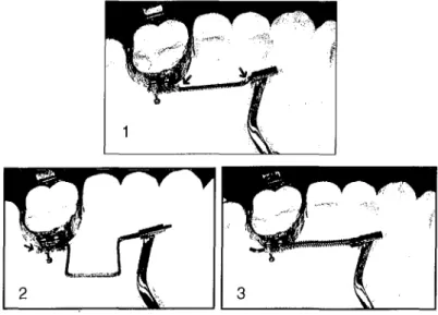 Figure 8 : « Suprastructure » de MÂNNCHEN, 1999, (36).