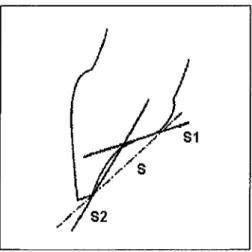 Figure 7: Schématisation de la surface linguale de guidage des incisives supérieures (d'après SLAVICEK, 129).