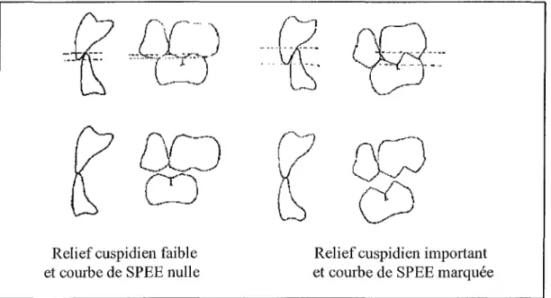 Figure 8: Le recouvrement incisif doit être augmenté lorsque le relief cuspidien et la courbe de SPEE sont augmentés (d'après PHILIPPE, 110, 112).