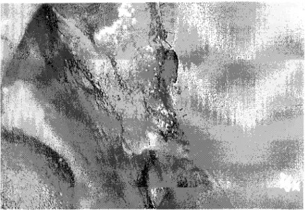 Figure 6 - Leucoplasie ponctuée de la muqueuse jugale commissurale. (54)