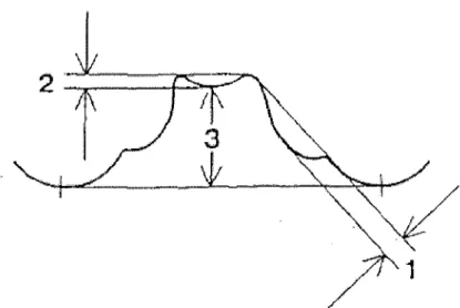 Figure 9 : Evaluation de la coupe transversale palatine 1 - Hauteur de la crête palatine latérale,