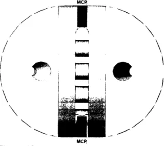 Figure  12:  Front side view of MCP segment