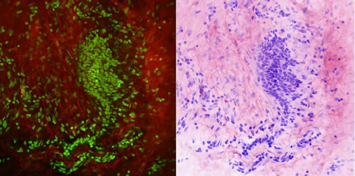 Figure 2. Region of normal breast tissue imaged with multiphoton microscopy with the eosin and DAPI channels rendered  as a virtual H&amp;E image