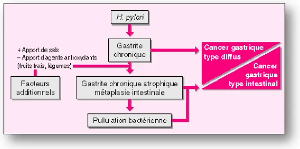 Figure 9 : Schéma de l'infection à  Helicobacter pylori  jusqu'au cancer gastrique (Source : Dobrilla et coll