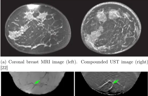 Fig. 1-1a and Fig. 1-1b, UST images are almost indistinguishable from MRI images.