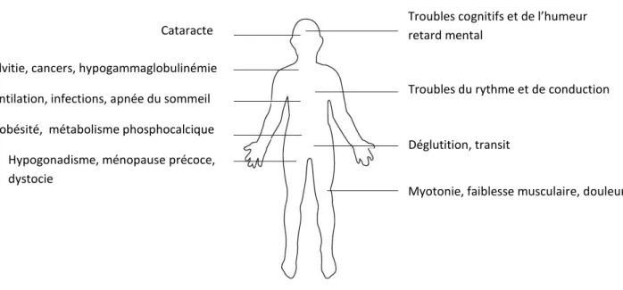 Figure 6 : les différentes atteintes cliniques possibles de la forme classique de la myopathie de Steinert Troubles cognitifs et de l’humeur retard mental 