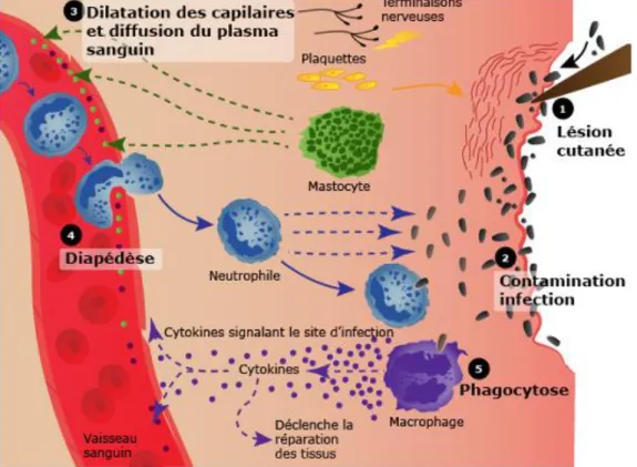 Figure 5. La réaction inflammatoire. Après lésion du tissu (1) ou infection (2), les mastocytes  induisent  la  vasodilatation  (3),  l’extravasation  de  fluides  et  facilitent  la  diapédèse  de  neutrophiles (4)