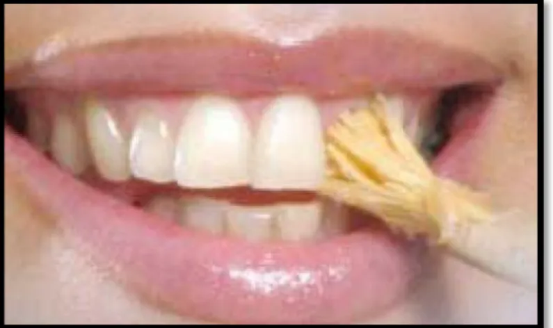Figure 20: brossage des dents antérieures – image my-sweet- my-sweet-islam.blogspot.com