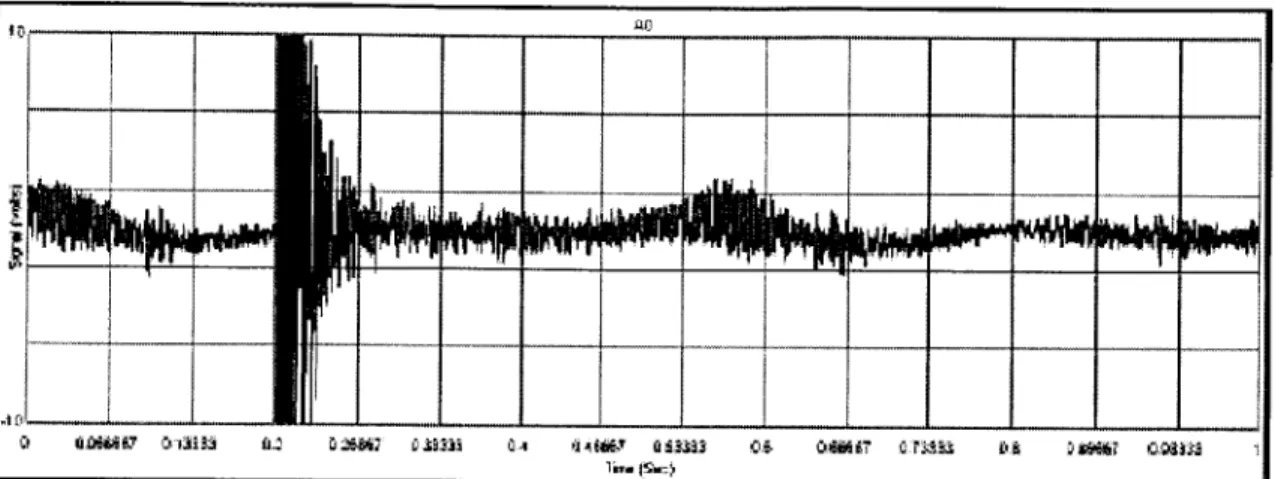 Fig.  17  A  one-second  recording  showing  a wire  fracture  and background  noise