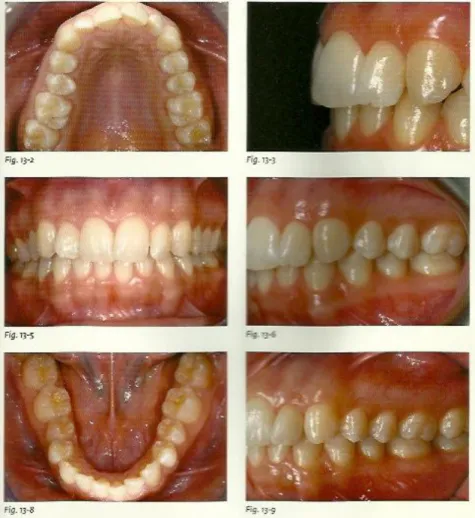 Figure n°1 : Les cadrages intrabuccaux en orthodontie 