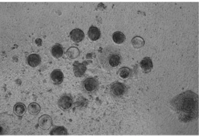 Figure 13: Ovocytes de brebis au milieu de cellules  folliculaires de la granulosa (objectif x10)