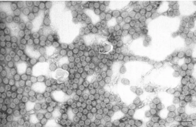 Figure 3 : Micrographe des virions du CaMV. Photo de microscopie électronique à transmission réalisée par Daniel Gargani à partir d'une purification du CaMV en gradient de saccharose