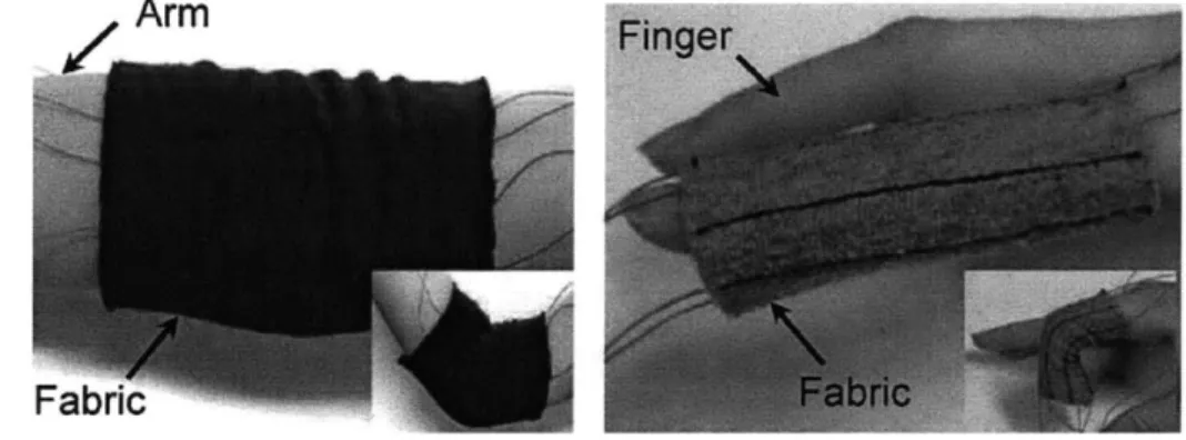Figure 2-5  Photograph  of fabrics worn on the elbow joint and the  finger  [28].