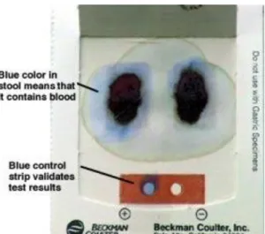 Figure 6: Résultat négatif de la recherche de sang dans les selles. 