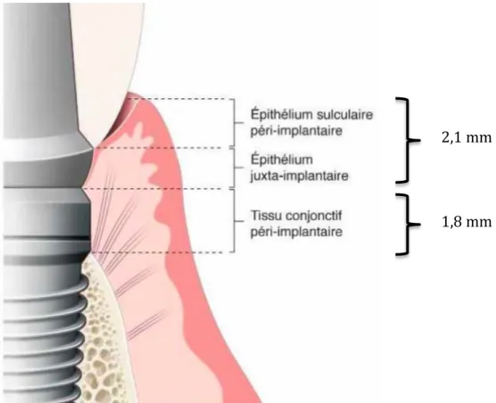 Figure 4 : Représentation schématique de l’espace biologique péri-implantaire  (Source : Parodontologie et dentisterie implantaire, P