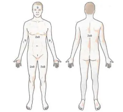 Figure 4. Règle de Lund et Browder. Les Brûlures. Masson Elsevier 2010 : 28. 