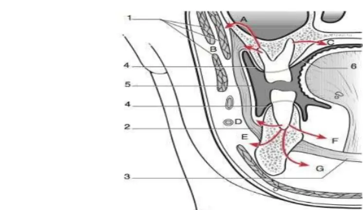 Figure 1: Voies de diffusion des cellulites d'origine dentaire : coupe frontale de la face passant par la première  molaire