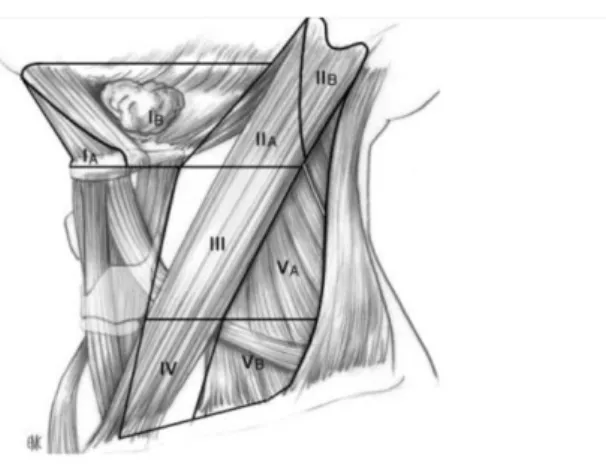 Figure 7 : Classification  de l’American Head and Neck Society (70) 