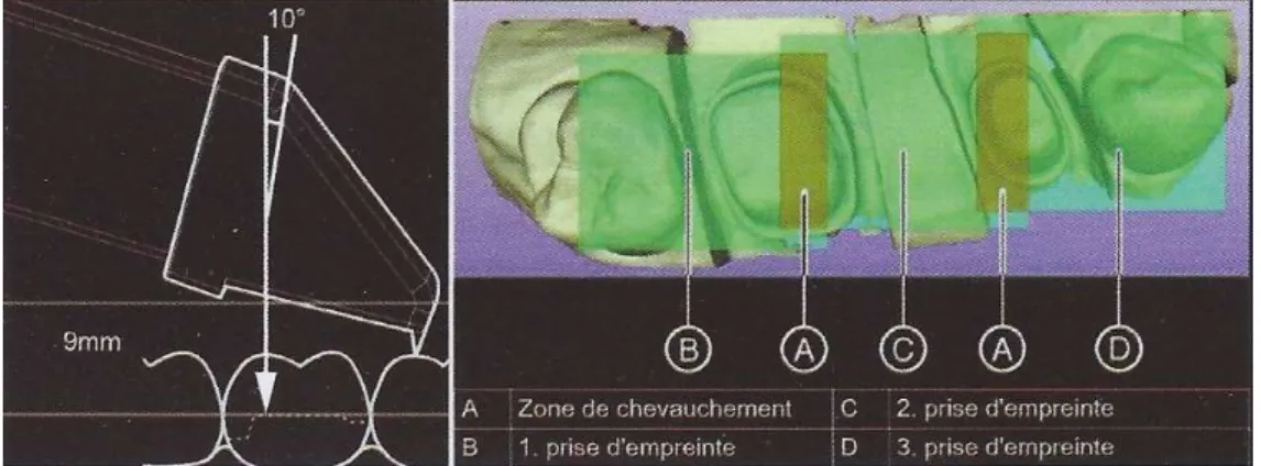 Figure 25 : Dispositif de stabilisation par appui du scanner 3D à gauche, technique de prise de vue  image par image à droite (Source : Stratégie prothétique mars-avril 2014, vol 14) 