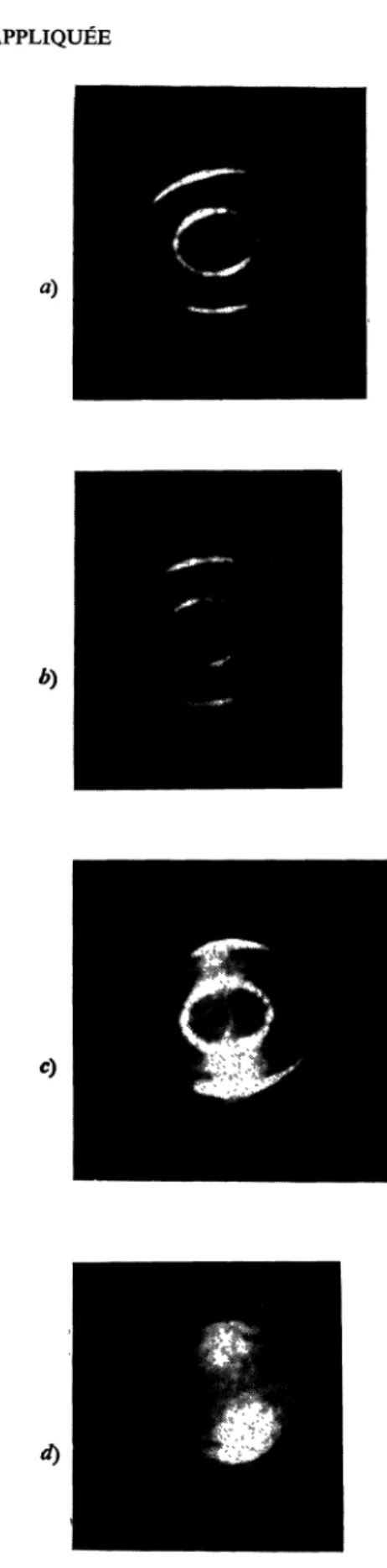 FIG.  4.  -  Analyse spectrale  avec  un  interféromètre  de  Pérot et  Fabry  de  la  lumière émise  par le  laser :  a)  référence : laser continu  seul ;  b)  laser  à  flash,  cas  de  synchronisation totale ; c)  laser  à  flash,  cas  de  synchronisa