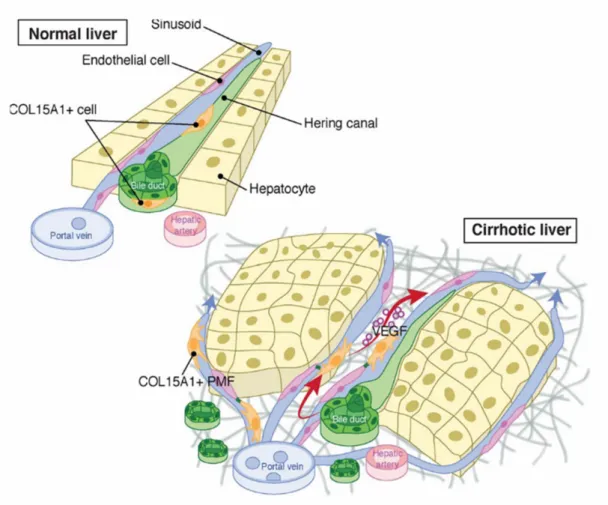 Figure 4 : Contribution des MFP au remodelage vasculaire au cours de la progression  de la fibrose hépatique 