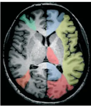 Figure 9. Territoire vasculaire des artères cérébrales (25) 