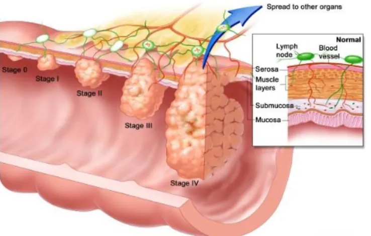 Figure 10 : CMS des CCR (d’après Guinney et al. 2015) 