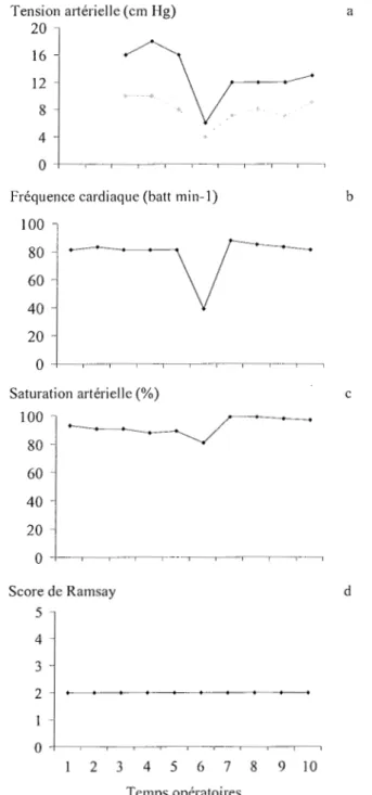 Figure I l .  Constantes et score de Ramsay du patient 30 (légendes similaires  à  la figure 10)