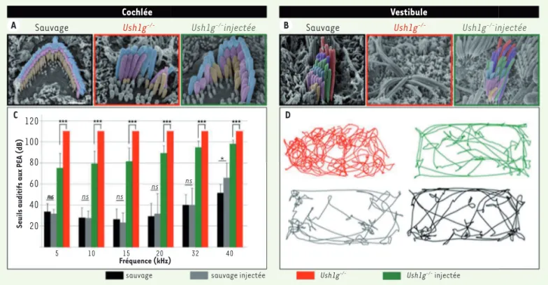 Figure 2. Le transfert viral de l’ADNc codant la protéine Sans restaure la structure et la fonction des cellules sensorielles de l’oreille interne