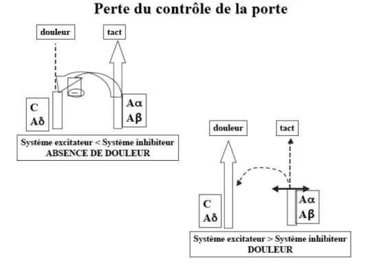 Figure 10 : schéma de la théorie du &#34;gate control&#34; (19) 