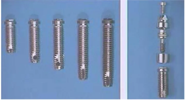 Figure 4 – Système implantaire deux pièces Brånemark Nobel Biocare ® . 