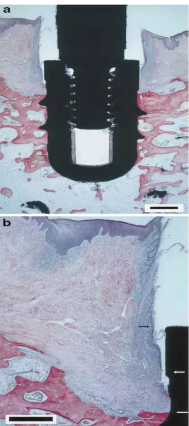 Figure 7 – (a) Coupe mésio-distale d’un implant deux pièces non enfoui. Coupe histologique  non décalcifiée