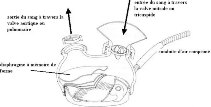 Figure 2. Description du cœur artificiel Jarvik-7-100. 