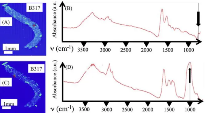 Figure  7.  B317  :  la  spectroscopie  IR  met  en  évidence  la  présence  de  dépôts  anormaux  constitués,  soit  d’oxalate  de  calcium  monohydraté  (A  et  B),  soit  de  phosphates  de  calcium  carbonatés, carbapatite et PACC (C et D)