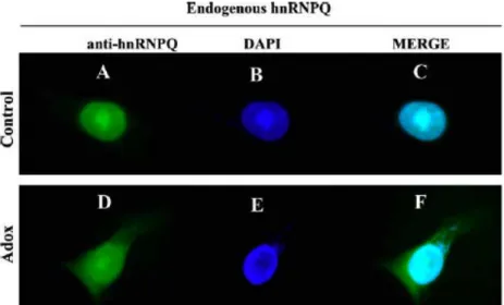 Figure  18 :  L’inhibition  de  la  méthylation  de  hnRNP  Q  conduit  à  sa  redistribution  au  cytoplasme