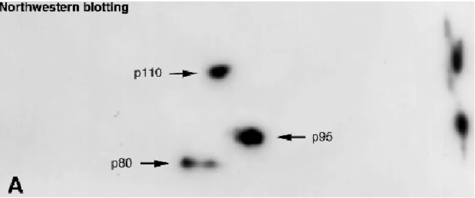 Figure 24 : Détection par Northwestern blot des protéines de liaison à la séquence ATE