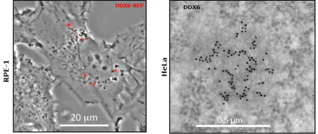 Figure 29 Visualisation des P-bodies marqués par DDX6 dans des cellules épithéliales humaines  Panneau de gauche : localisation de la protéine DDX6-RFP marquant les PB dans des cellules RPE-1  observées par microscopie à contraste de phase sur cellules viv
