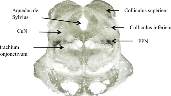 Figure 1: MLR chez le macaque   coupe transverse identifiant le CuN et le PPN  