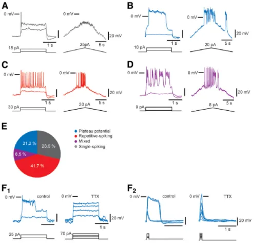 Figure 6. V1 R display different excitability patterns in E12.5 embryonic spinal cords