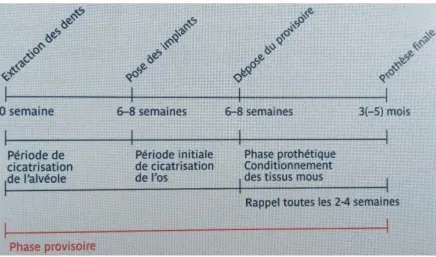 Figure 7 : Les différentes phases de temporisation (23) 