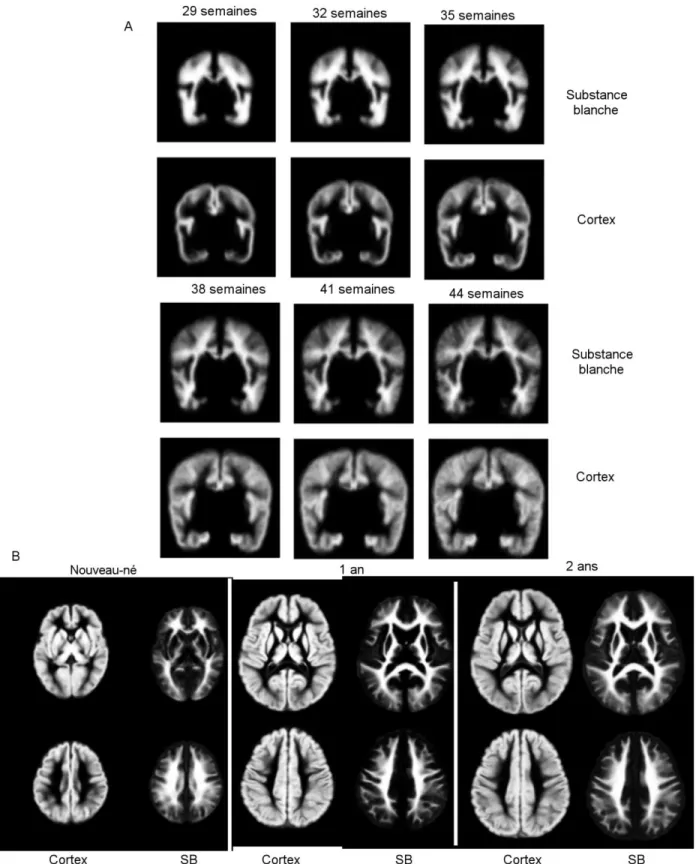Figure  19.  Illustration  des  atlas  du  cortex  et  de  la  substance  blanche  (SB)  A