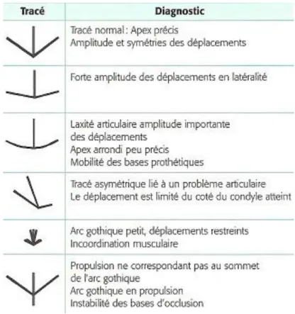 Tableau 2: analyse du résultat de GERBER (23) 