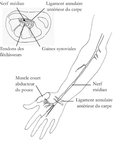 Figure 1. Schéma du trajet du nerf médian à l’avant-bras et au poignet, sous le ligament annu- annu-laire antérieur du carpe, avec coupe transversale du poignet montrant ses rapports dans le canal  carpien