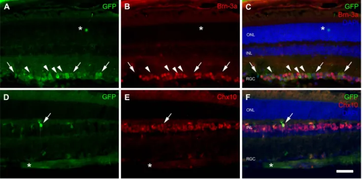 Figure 4. GFP expression in RGC and bipolar cells. Representative retina sections from adult mice treated for double-immunofluorescence analysis four weeks after the injection of 26 10 12 vg of scAAV9-GFP vectors into the tail vein